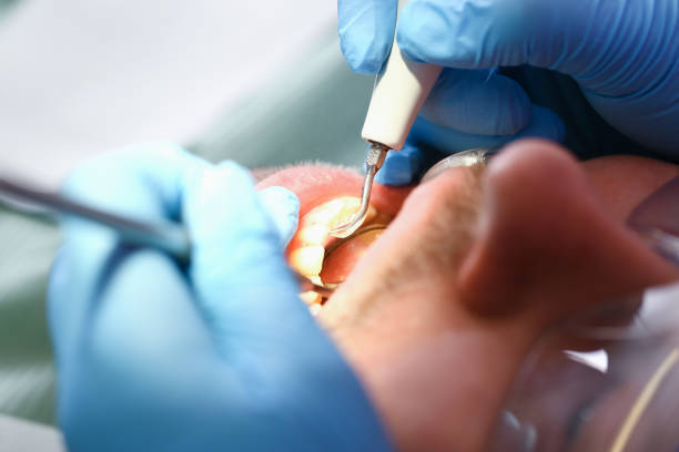 Best Emergency Tooth Extraction in Browns Mills, NJ
